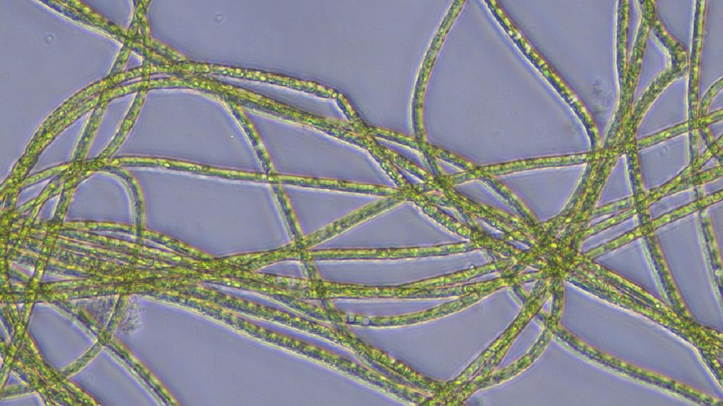 photo of microscopic algae